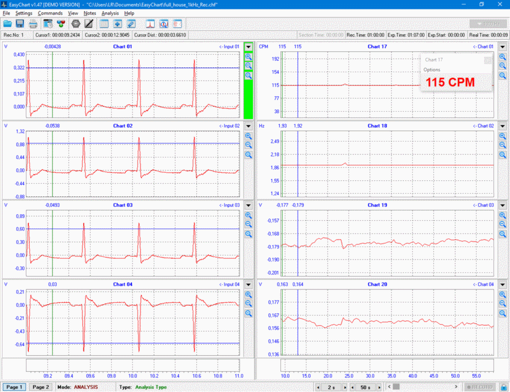 easychart