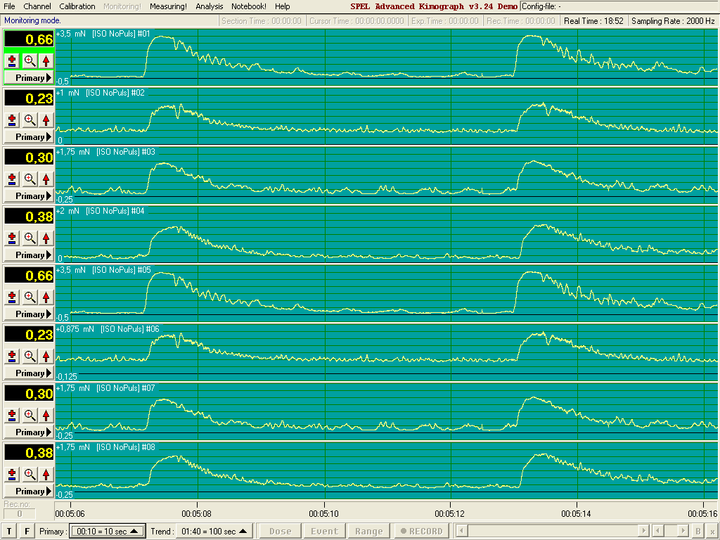 kymograph